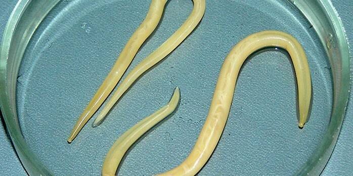 Human roundworms in a Petri dish - they parasitize on the walls of the small intestine