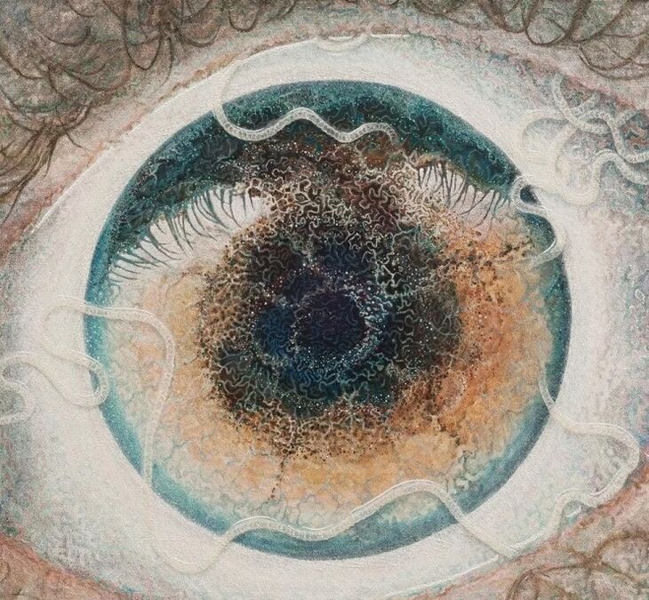 Ocular parasites