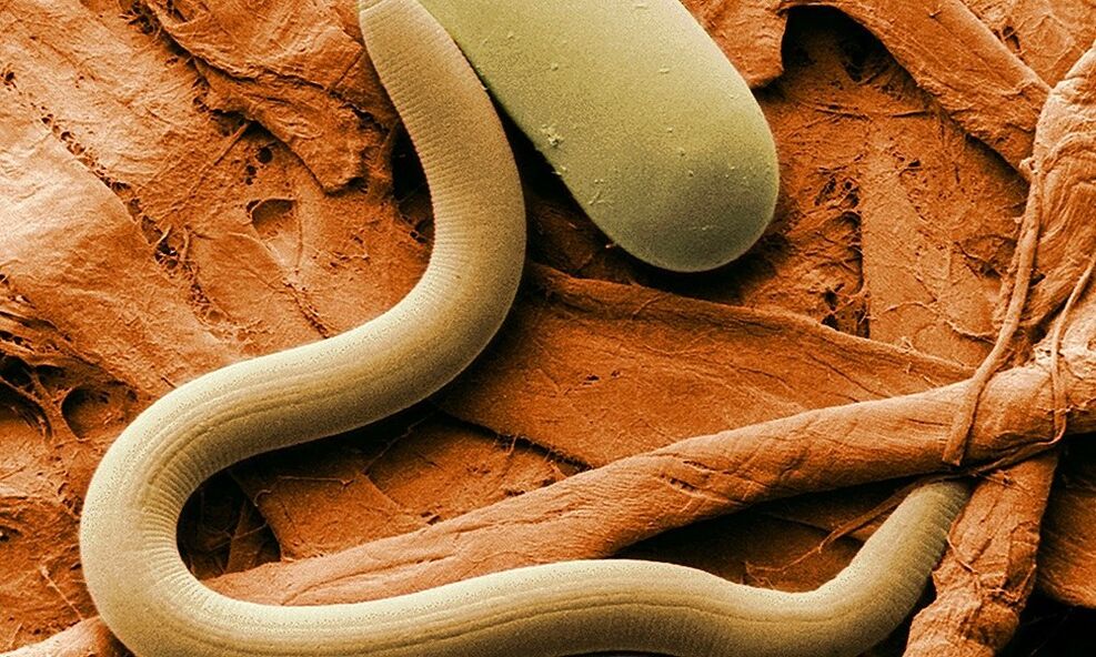 worm parasite of the human body