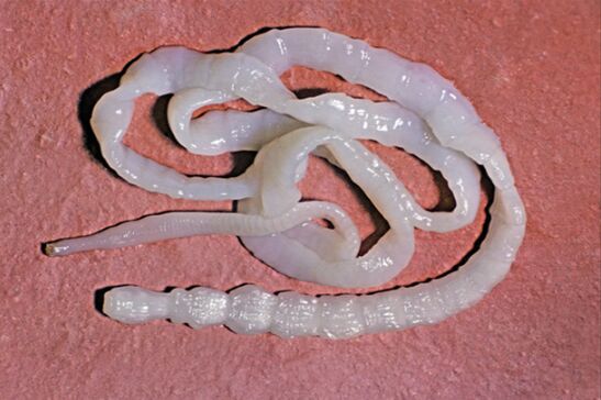 Pork tapeworm